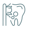 Fluoride Treatment